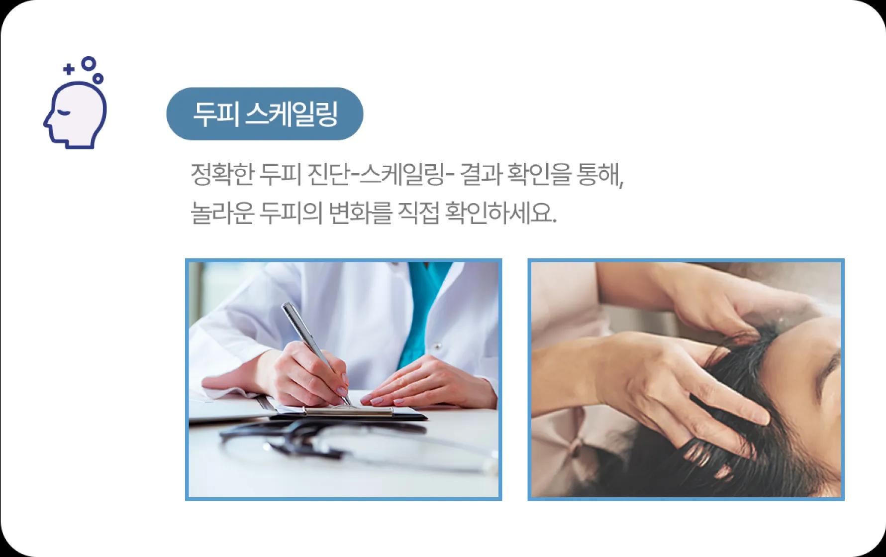 홀드 탈모치료 프로그램 2