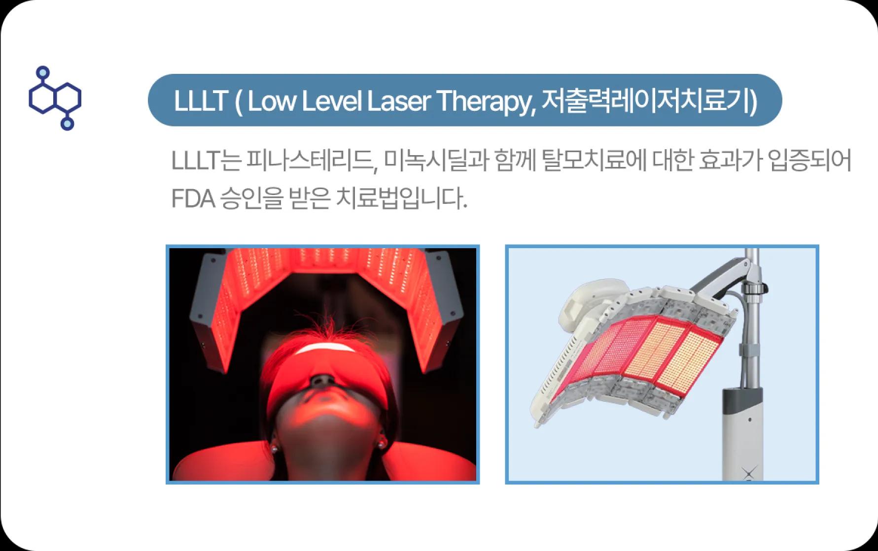 홀드 탈모치료 프로그램 4